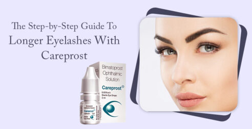 The Step-by-Step Guide to Longer Eyelashes with Careprost