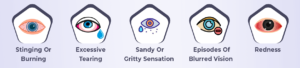 DRY EYE COMMON SYMPTOMS