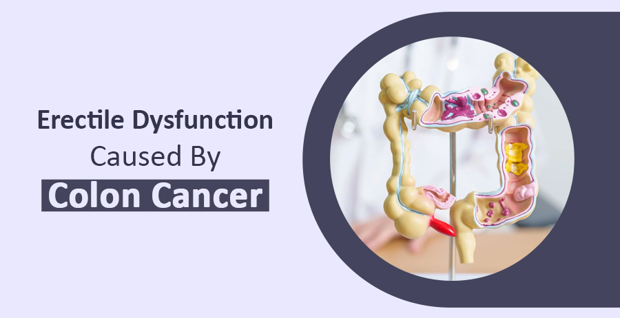 Erectile Dysfunction Caused By Colon Cancer
